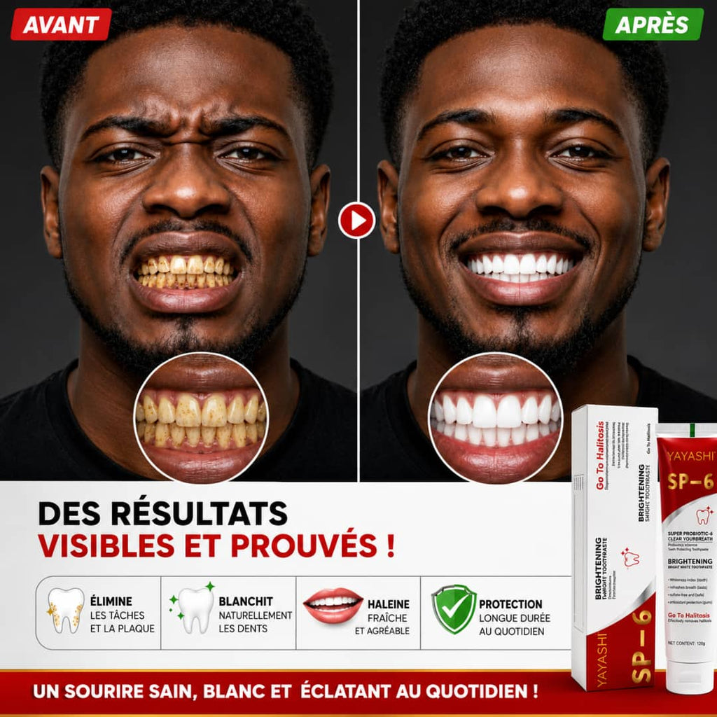 SP-6 Super Probiotic-6 Dentifrice Probiotique Brightening+